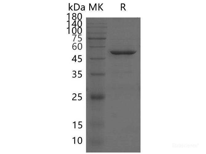 Recombinant SARS-CoV-2 NSP16 protein