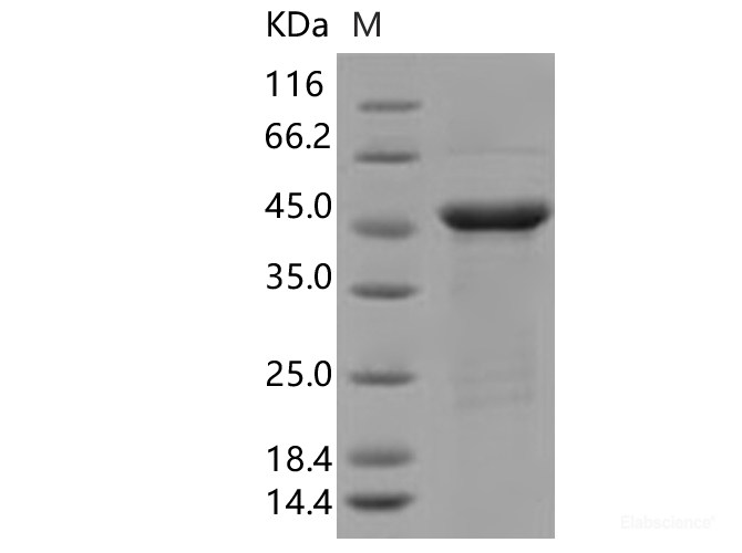 Recombinant SARS-CoV-2 N Protein (R203K, G204R)(His Tag)