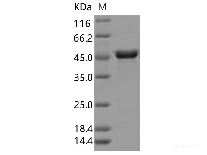 Recombinant SARS-CoV-2 N Protein (E378Q)(His Tag)