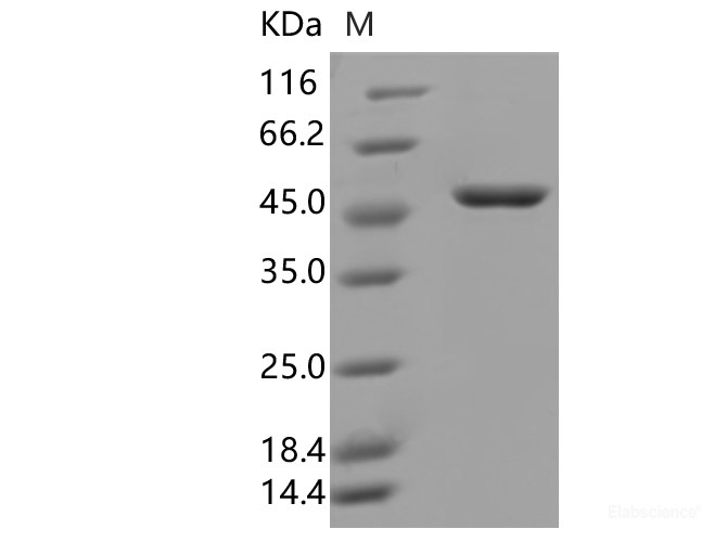 Recombinant SARS-CoV-2 N Protein (D3L,R203K,G204R,S235F)(His Tag)