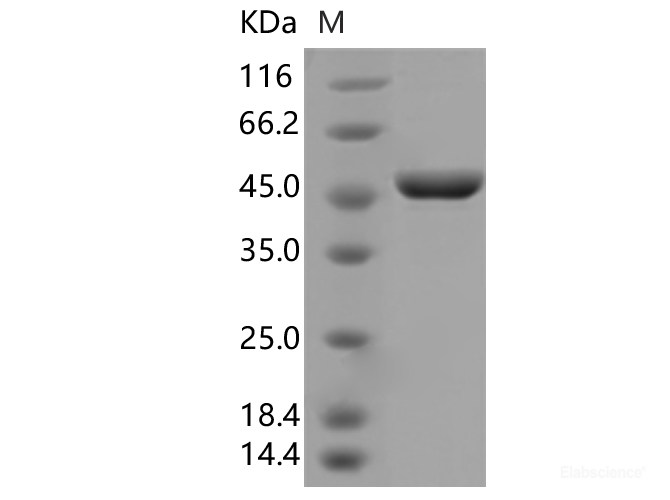 Recombinant SARS-CoV-2 N Protein (D3L,S235F)(His Tag)