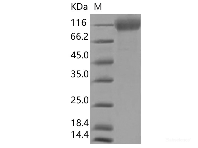 Recombinant SARS-CoV-2 Spike S1(ΔHV69-70,ΔY144,N501Y,A570D,D614G,P681H)(His Tag),Biotinylated