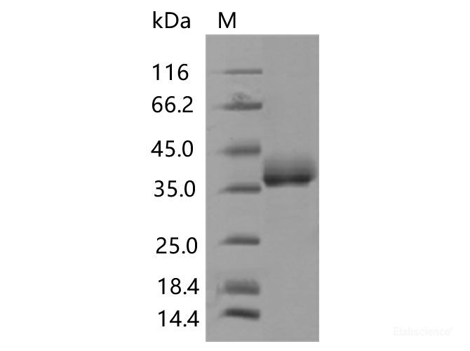 Recombinant SARS-CoV-2 Spike RBD(N501Y)(His Tag), Biotinylated