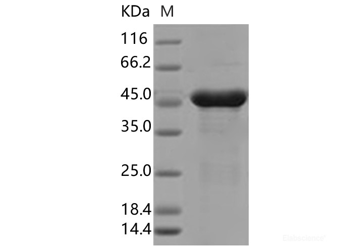 Recombinant SARS-CoV-2 N Protein (P13L)(His Tag)