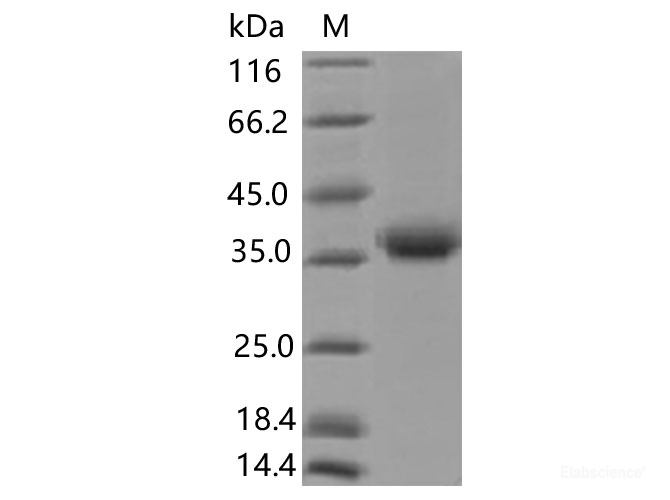 Recombinant SARS-CoV-2 Spike RBD(K417N)(His Tag), Biotinylated