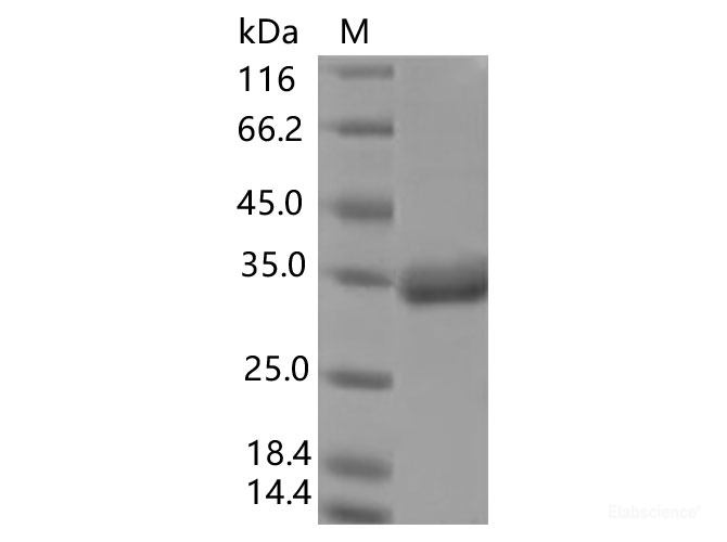 Recombinant SARS-CoV-2 Spike RBD(E484K)(His Tag), Biotinylated