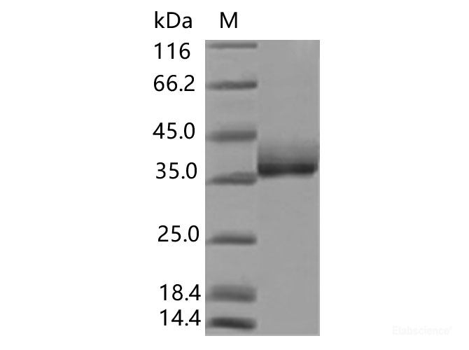 Recombinant SARS-CoV-2 Spike RBD(K417N, E484K, N501Y)(His Tag), Biotinylated