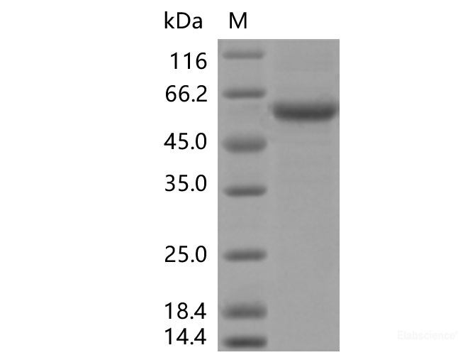 Recombinant SARS-CoV-2 Spike RBD (K417N, E484K, N501Y)(rFc Tag)