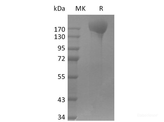 Recombinant SARS-CoV-2 ΔFVI-S trimer Protein(His Tag)