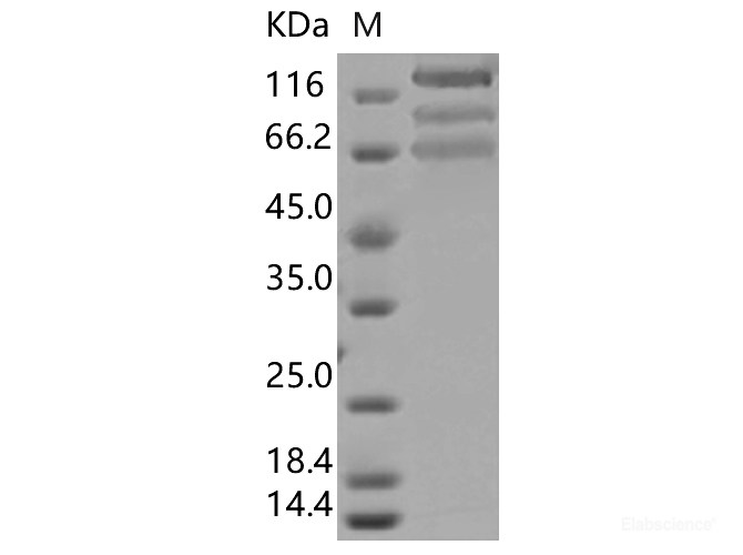 Recombinant SARS-CoV-2 Spike S1+S2 ECD (D614G)(His Tag)