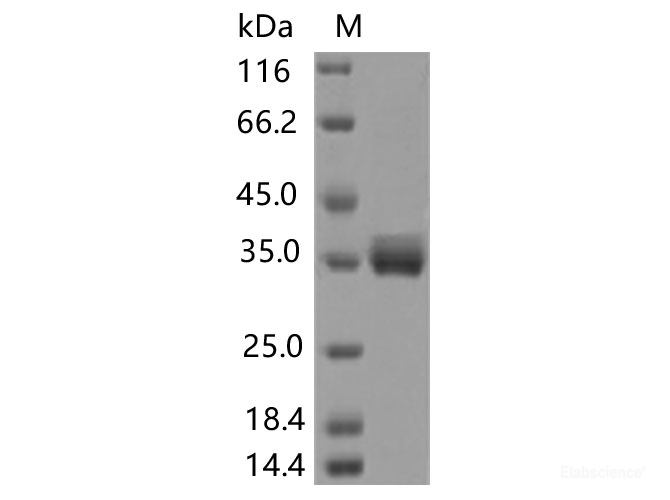 Recombinant SARS-CoV-2 Spike RBD(T385A)(His Tag)