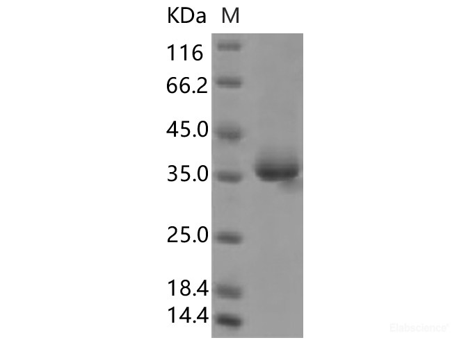 Recombinant SARS-CoV-2 Spike Protein (RBD, His Tag)(W436R)(Active)