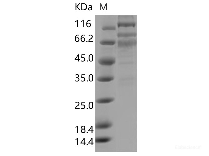 Recombinant SARS-CoV-2 S1+S2 Protein (ECD, C-His Tag)(Omicron)
