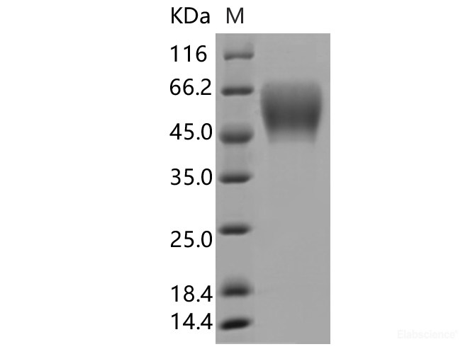 Recombinant SARS-CoV-2 Spike S1 NTD Protein (ECD, C-His Tag)(Omicron)