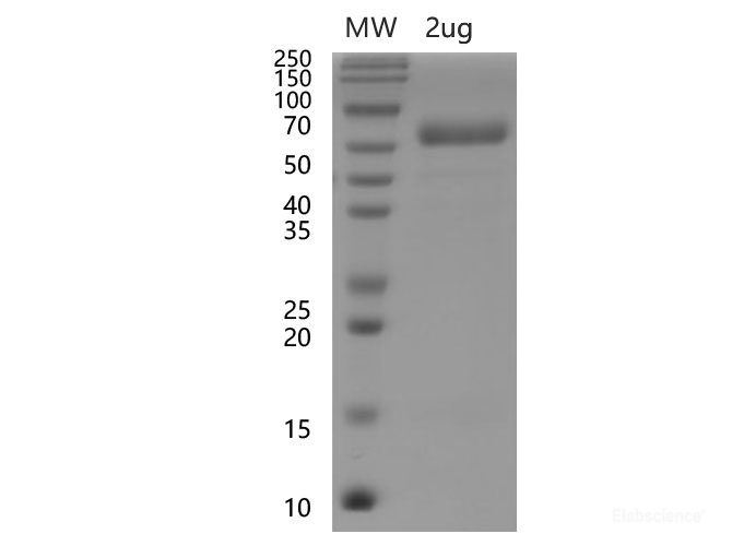 Recombinant SARS-CoV-2 Spike RBD Protein (C-hFc Tag)(Omicron)