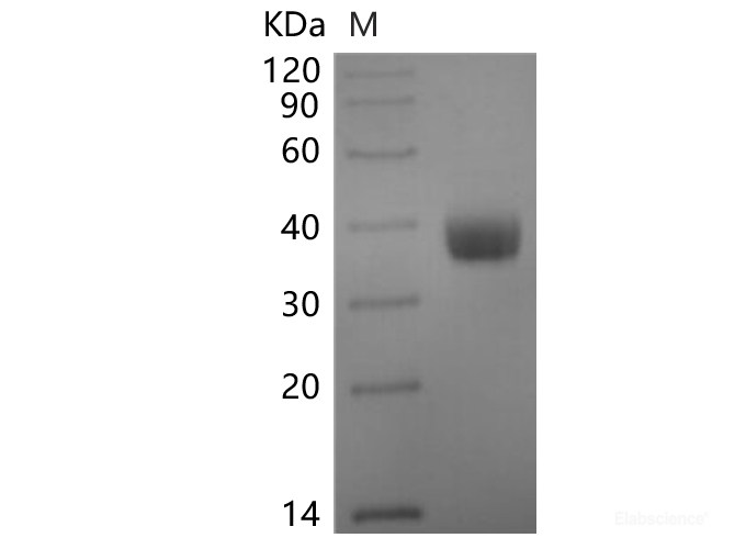 Recombinant SARS-CoV-2 Spike RBD Protein (C-6His-Avi)(Omicron), Biotinylated