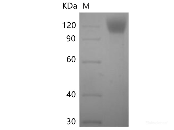 Recombinant SARS-CoV-2 Spike S1 Protein (C-His Tag)(Omicron)